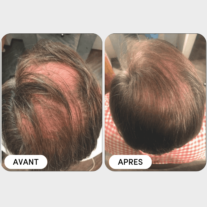 8 bouteilles-Huile'Agrandissement du Pénis XXXL, Produit Sexuel 8 bouteilles-Huile'Agrandissement du Pénis XXXL, Produit Sexuel